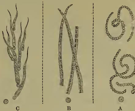 Figure 2: Three types of filamentous algae. A. Nostoc: a long, thin filament with a terminal heterocyst. B. Oscillatoria: a filament with a terminal heterocyst. C. Rivularia: a filament with a terminal heterocyst.