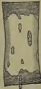A microscopic view of a muscle fiber, showing its internal structure. The fiber is surrounded by a sheath (sarcolemma) and contains internal striations. The image is a vertical rectangle.