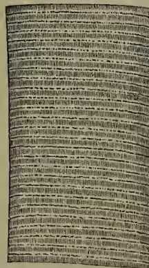 A highly magnified microscopic view of a portion of human muscular fiber. It shows a dense, regular pattern of transverse striations (Z-lines) and longitudinal striations (A-lines).