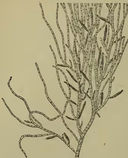 Figure 1: A detailed botanical illustration of a portion of the thallus of Ectocarpus confervoides. It shows a central axis with numerous small, cylindrical, multicellular sporangia attached to it. The thallus is branched and has a somewhat filamentous appearance.